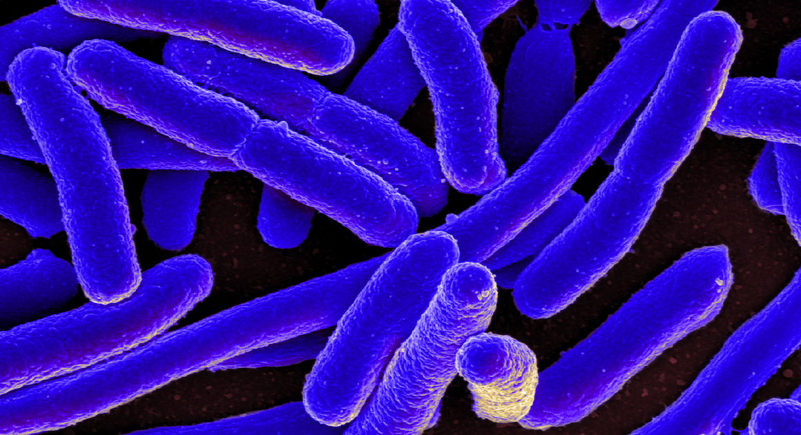 Scanning electron micrograph of Escherichia coli